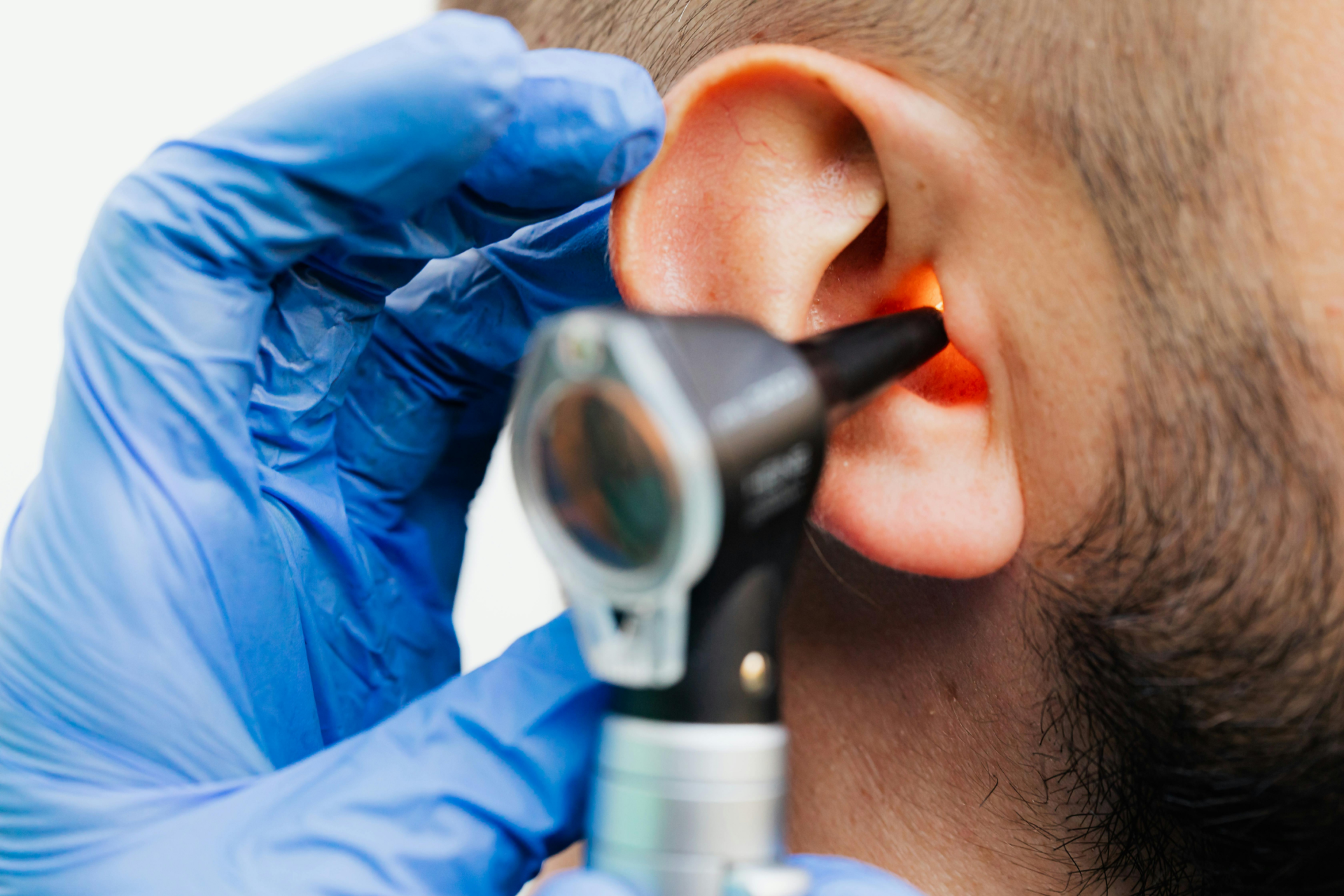 Ear wax microsuction